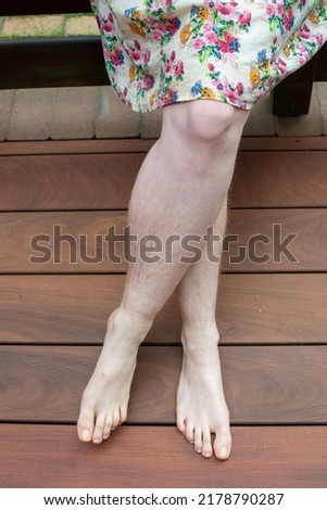 Natural unshaved hairy legs of a body positive young woman.