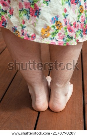 Natural unshaved hairy legs of a body positive young woman.