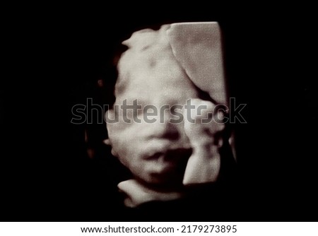 fetal baby ultrasound picture, pregnant experience Royalty-Free Stock Photo #2179273895