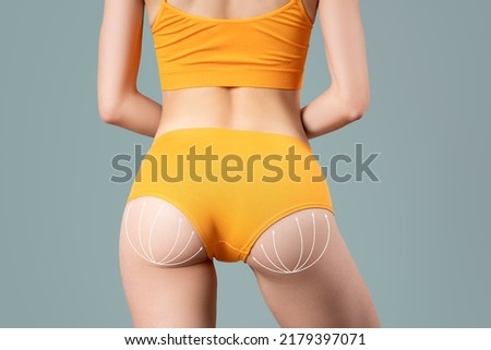 Buttocks liposuction, fat and cellulite removal concept, skinny female body with painted surgical lines on gray background Royalty-Free Stock Photo #2179397071