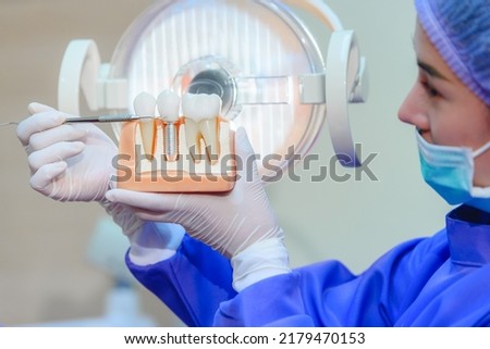 Dentist showing human teeth model and pointing to crown of Dental Implant. Knowledge about dental implants and caring for healthy teeth. Medical treatment at modern dental clinic or dentist office. Royalty-Free Stock Photo #2179470153