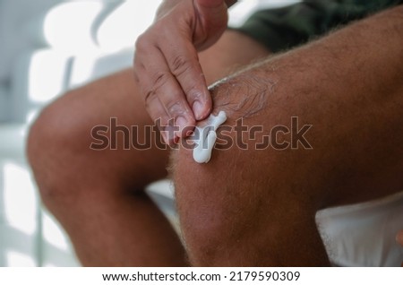A close up picture of man's knees and a hand spreading ointment over his knee. The man is getting treatment against knee pain after knee injury at the gym.