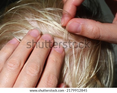 Finding and removing lice from the hair of a child's head