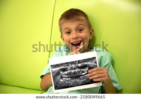 A 6-7-year-old boy is sitting on a green sofa in a dental clinic with a picture of his teeth in his hands. Boy with an 3d x-ray shows a fitted plate on a tooth