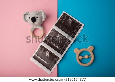 Boy or girl. ultrasound picture of a child with toys on a blue and pink background.