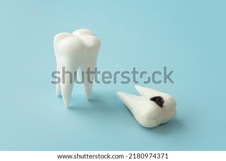 Teeth with bad sick damaged tooth on blue background. Decay, gum disease. Stomatology, dental problem, poor oral hygiene concept. a sick and healthy tooth concept. Royalty-Free Stock Photo #2180974371