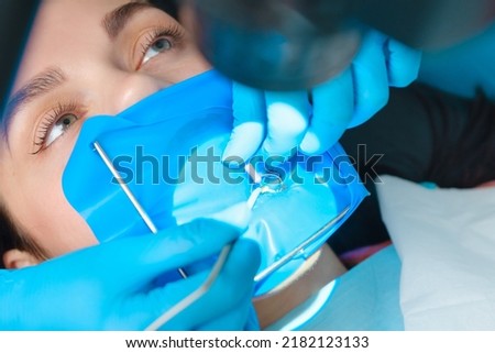 Photo endodontic treatment of dental canals in the lower molar permanent tooth molar with endodontic file with apex locator, tooth with clamp attached to it by cofferdam Royalty-Free Stock Photo #2182123133