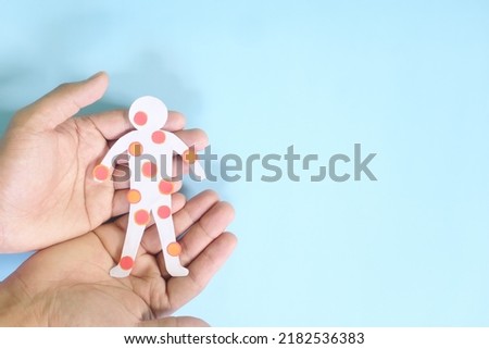 Pox disease such as monkeypox, smallpox and chicken pox care, prevention and protection concept. Hand holding human body cutout with red rash sores and blisters on skin in dark black background. Royalty-Free Stock Photo #2182536383