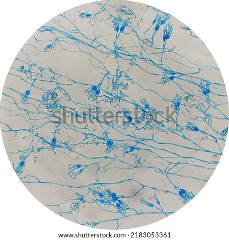 Penicillium sp.conidia and septate hyphae ,under the microscope 400X. Royalty-Free Stock Photo #2183053361
