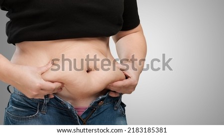 Obese woman against light background. Weight loss surgery Royalty-Free Stock Photo #2183185381