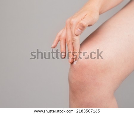 Woman applying ointment on knee for pain and swelling reduction. Leg injury treatment concept. Bruise, sprain, arthritis, overuse. Health care concept. High quality photo