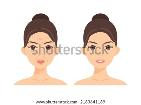 Woman with Wrinkles on Face. Wrinkles on Forehead, near Eyes, Mouth and Neck. Treatment. Before After. Lady with a Smile and Smooth Skin. Color Cartoon style. White background. Vector illustration. Royalty-Free Stock Photo #2183641189