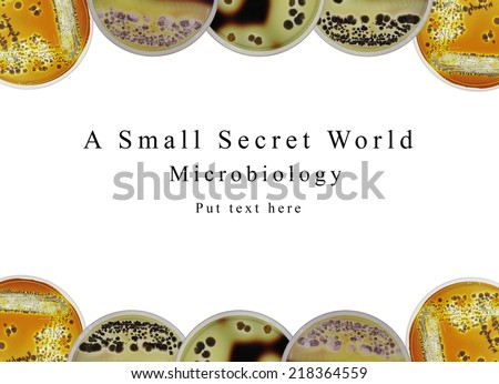 The background of powerpoint presentation microbiology science  show about the bacteria "Actinomycetes" streak on starch agar plate. Clear zone indicated enzyme production degrading starch.