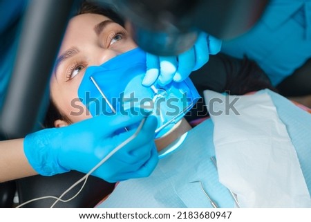 photo endodontic treatment of dental canals in the lower molar permanent tooth molar with endodontic file with apex locator, tooth with clamp attached to it by cofferdam Royalty-Free Stock Photo #2183680947