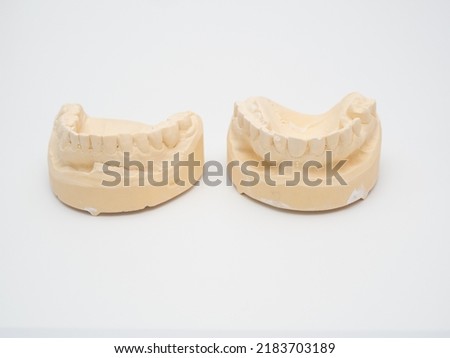 Plaster model or cast of human teeth. Teeth model on a white background. Royalty-Free Stock Photo #2183703189