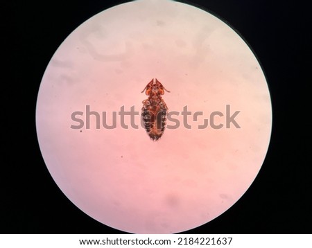 Cat lice is a external parasites, common to see on the cat fur.