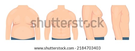 Weight loss illustration. Belly of a man before and after weight loss. Vector illustration Royalty-Free Stock Photo #2184703403