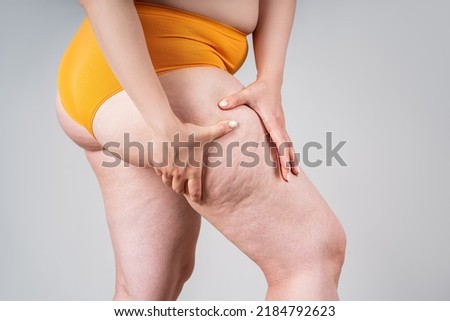 Overweight woman, fat thighs and buttocks, obesity female legs with cellulite on gray background Royalty-Free Stock Photo #2184792623