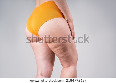 Overweight thigh, woman with fat hips and buttocks, obesity female body with cellulite on gray background, studio shot Royalty-Free Stock Photo #2184792627