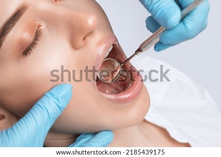 A dentist doctor treats caries on a tooth of a young beautiful woman in a dental clinic. Tooth filling. Royalty-Free Stock Photo #2185439175