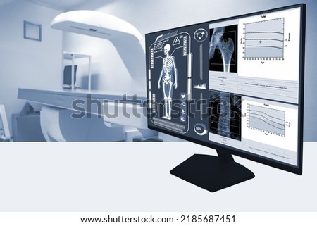 Abstract blurred photo close up  examines whole body bone density images of patient during a health check and consultation.Selective focus image Royalty-Free Stock Photo #2185687451