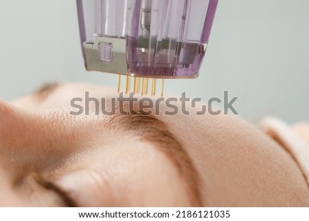 Microneedle mesotherapy. Woman receiving micro needling rejuvenation treatment in a cosmetology clinic. Royalty-Free Stock Photo #2186121035