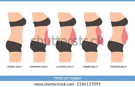 Illustration of Types Of Tummies for woman, body type, health, weight problem Royalty-Free Stock Photo #2186137099