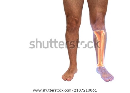 View of the fibula and tibia bones of a man on a white isolated background Royalty-Free Stock Photo #2187210861