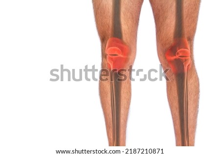 Transparent image of femur, fibula and tibia bones of a man suffering from joint pain on white isolated background