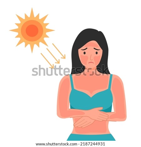 Woman with sunburn on her face and body skin in flat design. UV radiation damage skin in hot summer day. Royalty-Free Stock Photo #2187244931