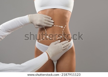 Body Contouring Concept. Unrecognizable Doctor Wearing Gloves Touching Female Body With Marked Lines In Abdomen Zone, Woman Patient Preparing For Liposuction Plastic Surgery, Cropped Shot Royalty-Free Stock Photo #2187911123