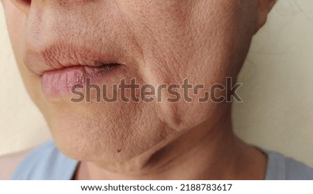 portrait showing the wrinkles skin, Flabby sagging and dry skin beside the mouth, blemishes and dark spots on the face, problem wrinkled and flabby skin of the Middle-aged woman, concept health care. Royalty-Free Stock Photo #2188783617