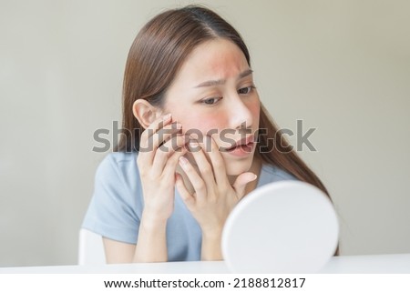 Dermatology, scratch asian young woman looking at mirror, expression worry and itch, itchy allergy or allergic sensitive reaction, red spot or rash on her face. Beauty care from skin problem treatment Royalty-Free Stock Photo #2188812817