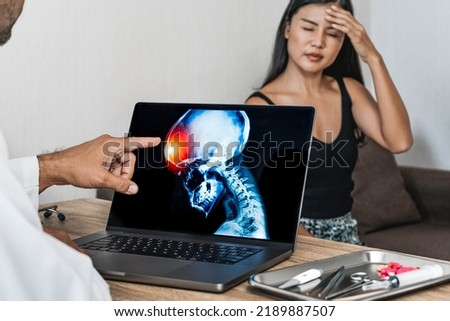 Doctor showing a x-ray of pain in the brain on a laptop. Migraine Headache Royalty-Free Stock Photo #2189887507