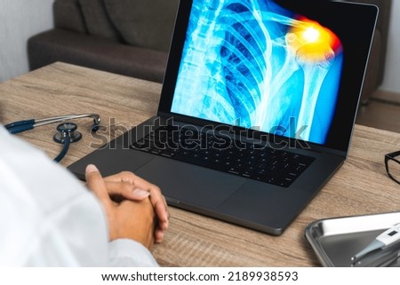 Doctor looking a x-ray of pain in the shoulder on a laptop.  Royalty-Free Stock Photo #2189938593