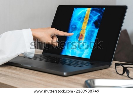 Doctor showing a x-ray of pain in the spine. Backache trauma Royalty-Free Stock Photo #2189938749