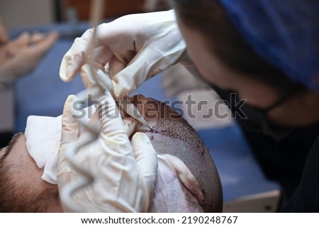 Hair transplant patient in the end of the operation
 Royalty-Free Stock Photo #2190248767