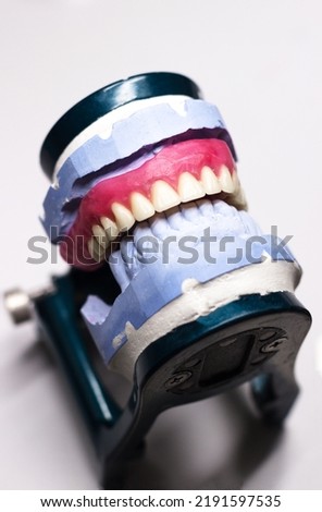 A jaw with ceramic teeth. Dentist's device. High quality photo