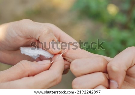 The woman is trying to pull the splinter out of the child's hand. A splinter in a child's hand. Royalty-Free Stock Photo #2192242897