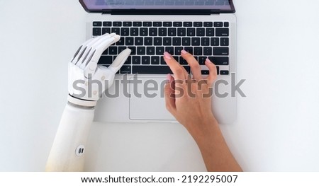 Top view woman using prosthetic arm working notebook computer, girl with disability learning , typing text artificial prosthetic limb hand Royalty-Free Stock Photo #2192295007