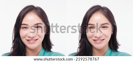 Beautiful woman Asia before and after acne treatment No makeup, close up. Skin care concept White background