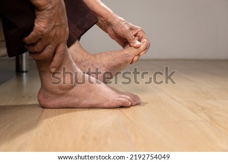 Senior woman massage foot with painful swollen gout inflammation