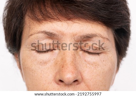 Upper part of elderly woman's face with signs of skin aging isolated on white background. Age-related changes, flabby sagging facial skin, wrinkles and creases on the eyelids and puffiness under eyes Royalty-Free Stock Photo #2192755997