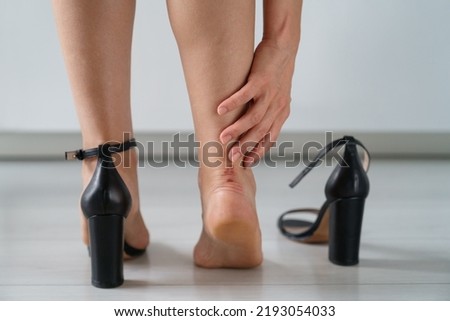 Woman feet in pain after wearing high heeled shoes after walking, closeup back view. touching the painful sore on her leg with her fingers. Tired female takes off tight shoes after work at home.  Royalty-Free Stock Photo #2193054033