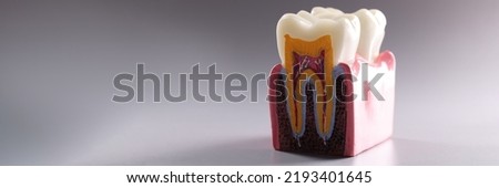 Mock tooth in section, educational model of tooth, anatomy of human oral tooth Royalty-Free Stock Photo #2193401645