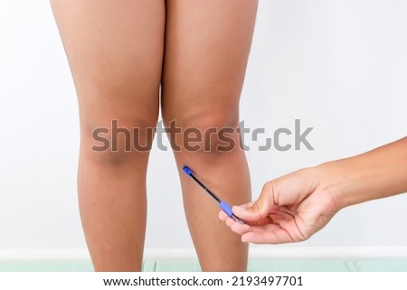 photo of children's knees close-up, on examination by an osteopath doctor. Pediatric orthopedics, examination for Valgus deformity of the knee, suspicion and diagnosis, pediatric therapist. Royalty-Free Stock Photo #2193497701