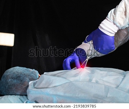 A spinal surgeon performs a hernia surgery on a patient's back. Myelopathy, copy space for text Royalty-Free Stock Photo #2193839785
