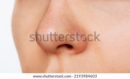 Close-up of a woman's nose with blackheads isolated on a white background. Acne problem, comedones. Enlarged pores on the face. Cosmetology dermatology concept. Black dots on the female nose Royalty-Free Stock Photo #2193984603