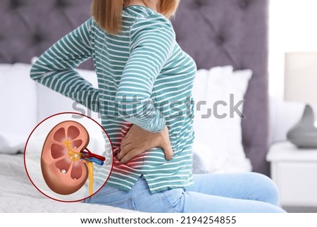 Woman suffering from pain because of kidney stones disease at home Royalty-Free Stock Photo #2194254855