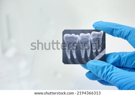 Doctor holding x-ray picture of teeth indoor